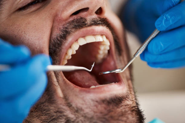Full Mouth Reconstruction in Dubois, PA
